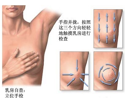 双侧乳腺小叶增生的症状及治疗方法