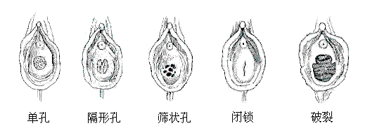女性阴道生理结构图 最真实的女人阴道图片