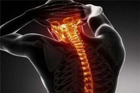 脊椎病会引起背痛吗