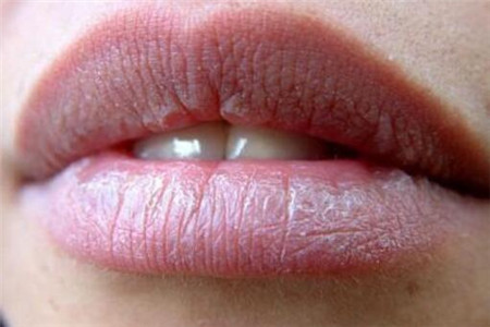 女人嘴唇发紫