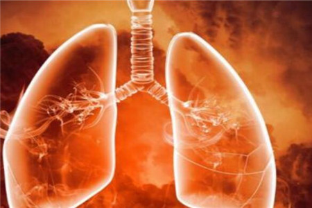 肺癌晚期
