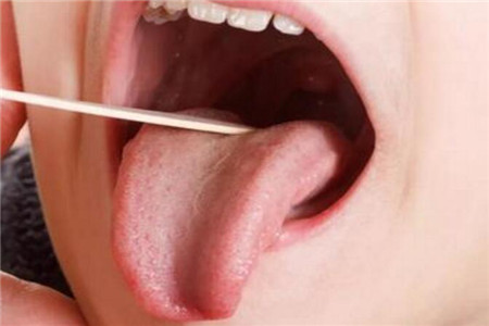 舌头异常