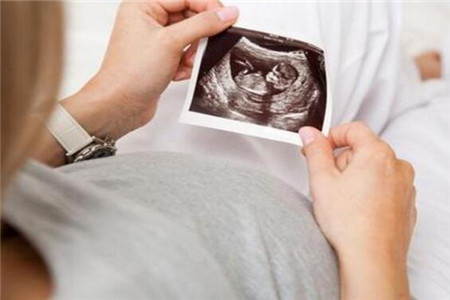 孕早期注意什么