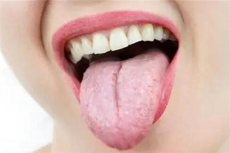 舌头癌症